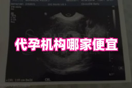 长春助孕网 4